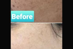 109